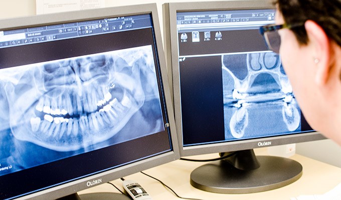 Röntgenbilder på en skärm